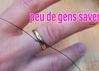 Un médecin m’a montré comment enlever la bague coincée sur mon doigt