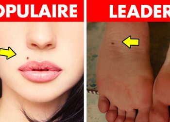 Ce que disent les grains de beauté à différents endroits de votre corps