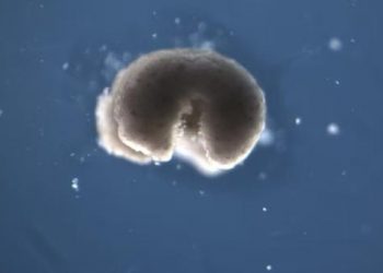 Des chercheurs étudient la vie après la mort – et c’est de plus en plus bizarre