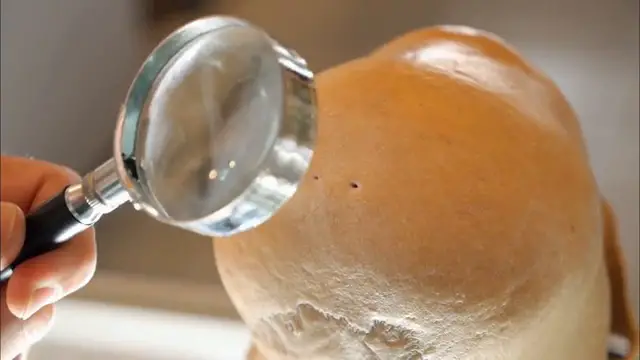 Examen détaillé d'un crâne allongé montrant l'absence de suture sagittale, une caractéristique anatomique inhabituelle.