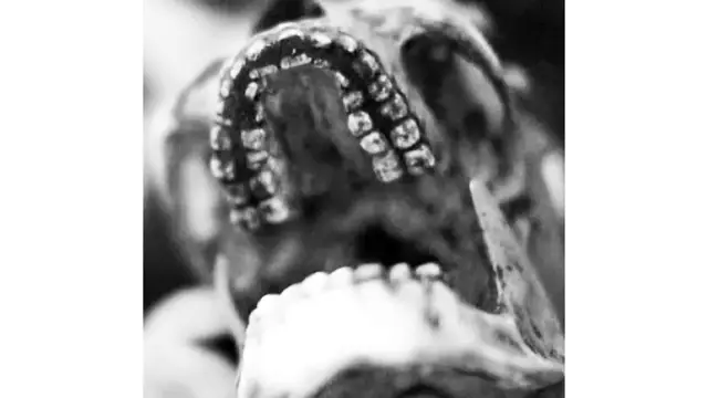 Gros plan sur un crâne humain ancien présentant une mâchoire avec une double rangée de dents, une anomalie anatomique souvent citée dans les récits sur les géants.