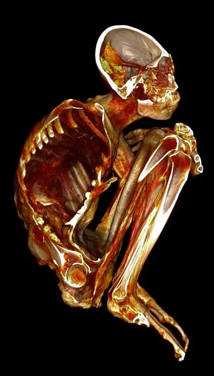 Maria, momie hybride de Nazca.