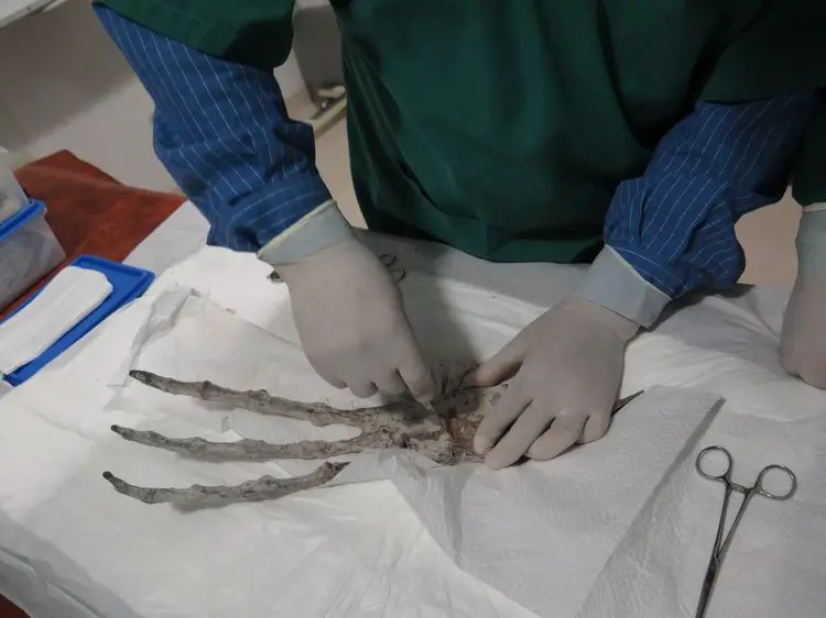 Momie de Nazca. Main tridactyle.