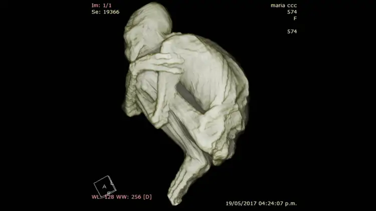 Vue en 3D d'une tomographie montrant la structure squelettique complète de la momie nommée Maria, dans une position fœtale.