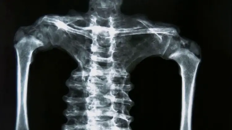 Radiographie montrant la structure osseuse du torse et des membres, utilisée par les experts pour analyser l'anatomie non humaine.