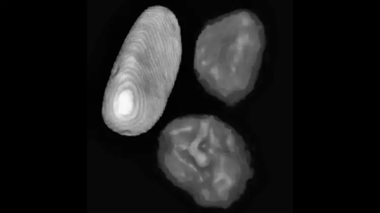Visualisation des œufs trouvés dans l'abdomen de la momie, avec une comparaison montrant le fœtus à l'intérieur.